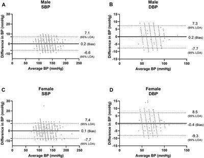 Influence of Sex, BMI, and Skin Color on the Accuracy of Non-Invasive Cuffless Photoplethysmography-Based Blood Pressure Measurements
